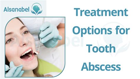 Tooth Abscess Causes Symptoms And Treatment 2024 مركز السنابل للأسنان