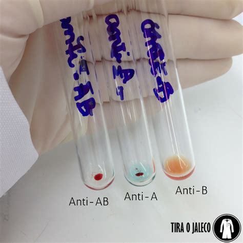 Fenotipagem ABO e Rh Prática Tira o Jaleco