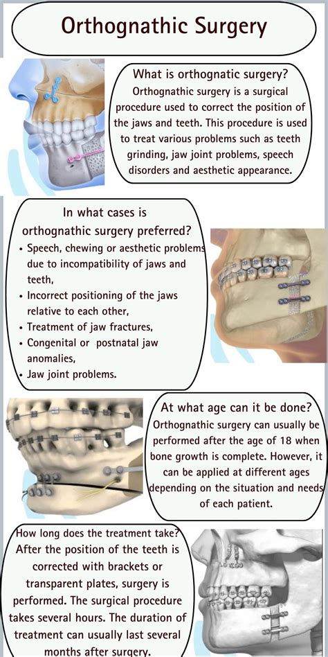 Orthognathic Jaw Correction Surgery Dental Health Clinic Turkey