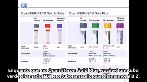 Quantiferon Tb Gold Plus Quantiferon Us