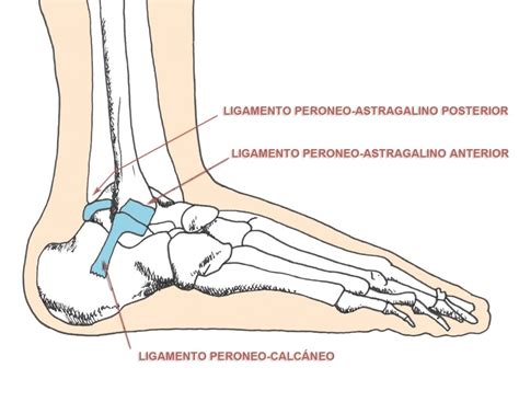 Cómo recuperarse de un esguince de tobillo ITRAMED