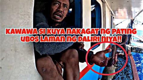 Kawawa Naman Si Kuya Nadali Ng Pating Ubos Ang Laman Ng Isang Daliri