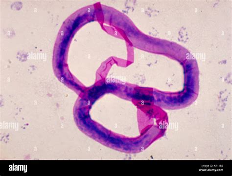 Tinción De Giemsa Microfilaria Fotografías E Imágenes De Alta Resolución Alamy