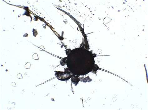 Rhytisma Salicinum Fungus Causing Tar Spot Microfungi Fennici