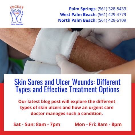 Skin Sores and Ulcer Wounds: Different Types and Effective Treatment Options