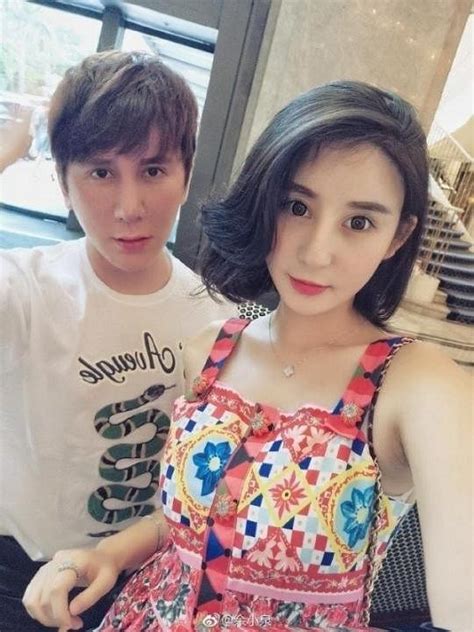 李晨录影额头受伤缝9针 网红夫妻整成范冰冰＋李晨 联合早报