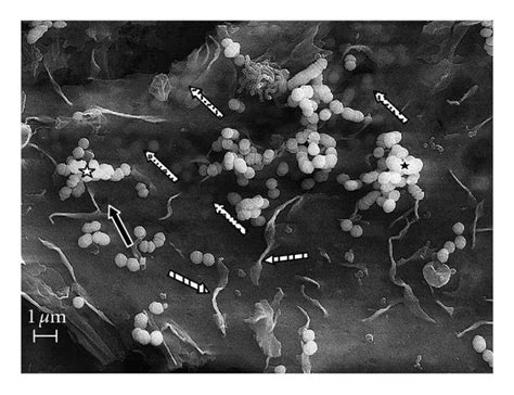 Scanning Electron Microscopy Sem Of Cocultures Of Bovine Mammary