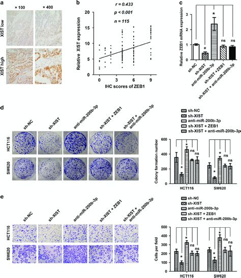 Zeb1 Expression Mediated The Biological Effects Exerted By Lncrna Xist