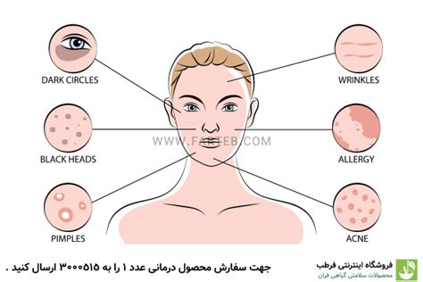 5 تا از علائم کبد چرب روی پوست آپدیت 1402 روش درمان