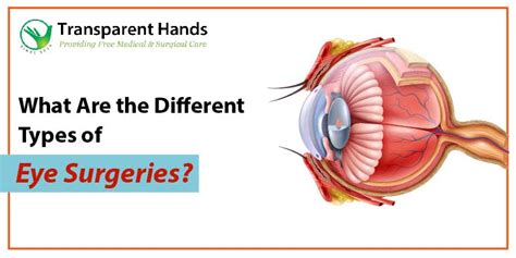 Retinal Surgery, Symptoms, Causes, Treatment & More