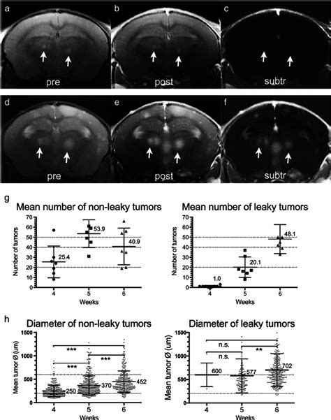 Evaluation of tumor burden and tumor leakiness using MRI with Prohance ...