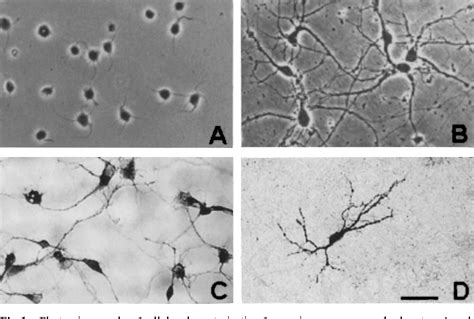 A Serum And Antioxidant Free Primary Culture Model Of Mouse Cortical