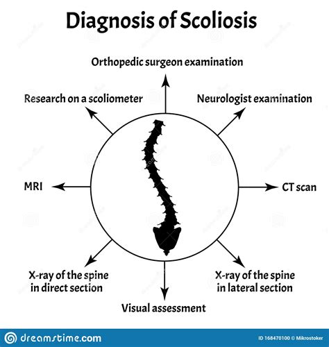 Diagnosi Della Scoliosi Curvatura Spinale Cifosi Lordosi Del Collo