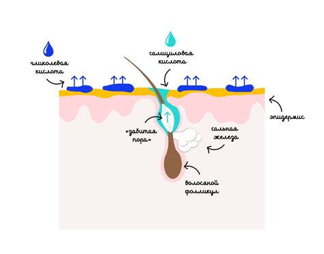 Салициловая или гликолевая?