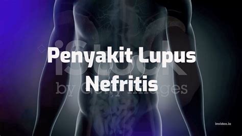 Apakah Itu Penyakit Lupus Nefritis Youtube