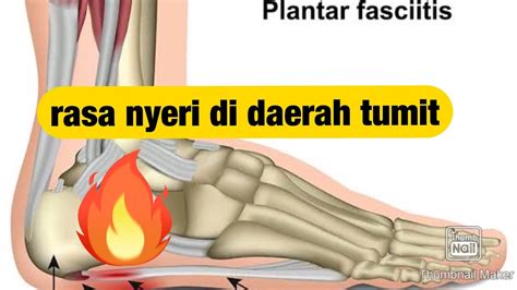 Nyeri Telapak Kaki Bagian Belakang Mengobati Nyeri Telapak Kaki Youtube