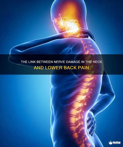 The Link Between Nerve Damage In The Neck And Lower Back Pain Medshun