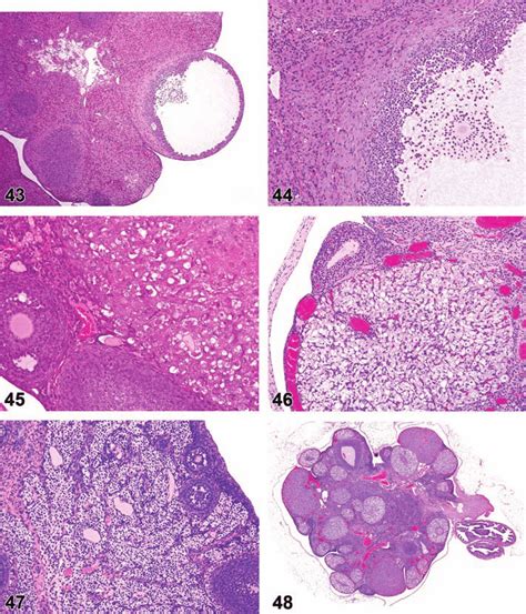 Cystic Luteinized Follicle Ovary Rat Figure 44 Cystic Luteinized