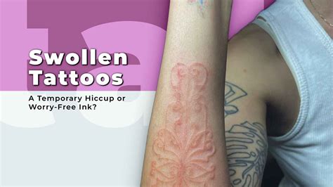 Swollen Tattoos A Temporary Hiccup Or Worry Free Ink