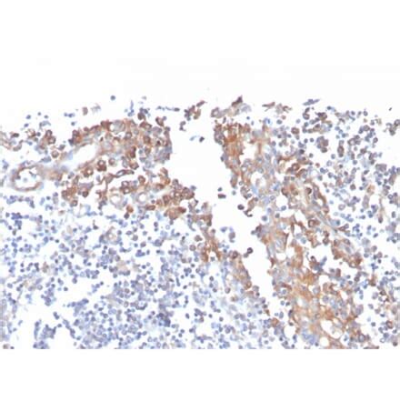 cd antibodies antibodiescom