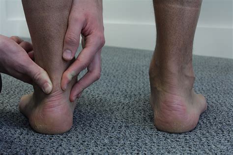 Achilles Tendonitis The Ankle Biomechanical Problems What We