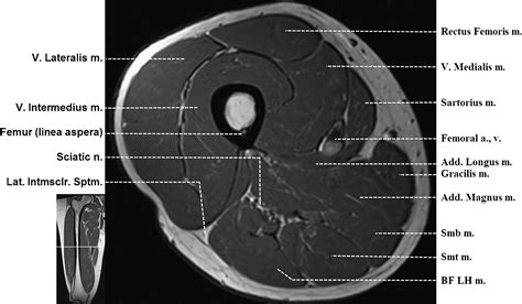 Supplemental Materials For Normal Mr Imaging Anatomy Of The Thigh And