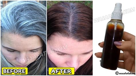 With Only 3 Ingredients Remove Your Gray Hair Permanently And Naturally Youtube