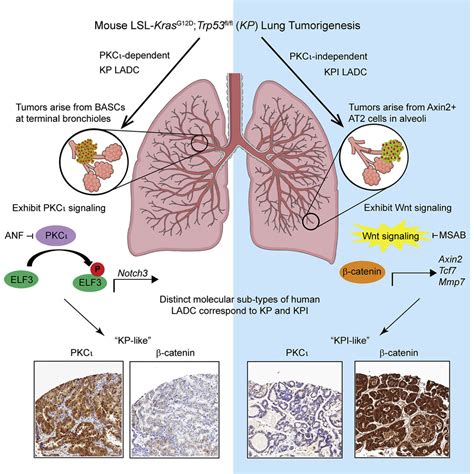 Protein Kinase C And Wnt Catenin Signaling Alternative Pathways To