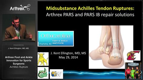 Arthrex Arthrex Foot And Ankle Innovation For Sports Surgeons