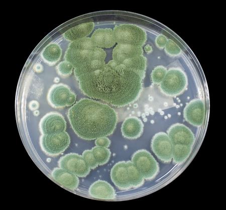 Photo De Colonies Of Penicillium Fungi ID 124154775 Image Libre De