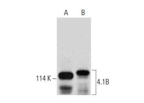 41b Antibody A 7 Scbt Santa Cruz Biotechnology