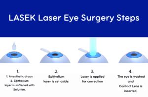 LASEK Laser Eye Surgery - Smart Laser Eye Center