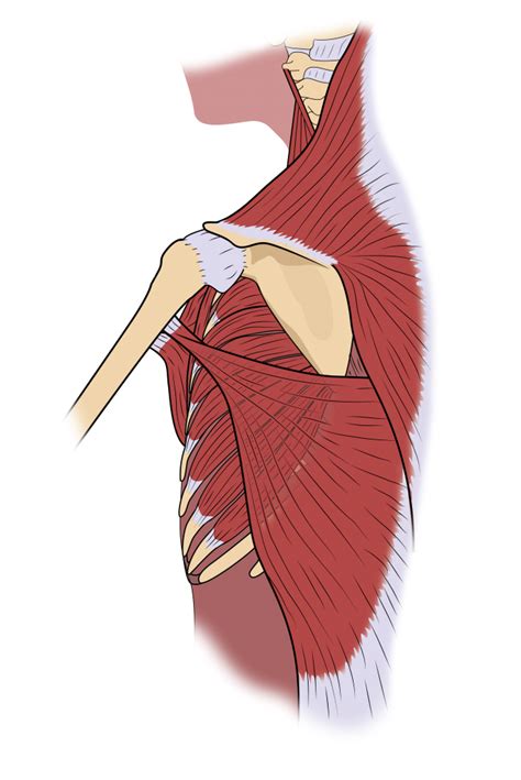 Shoulder Rehab After Breast Cancer De Souza Institute