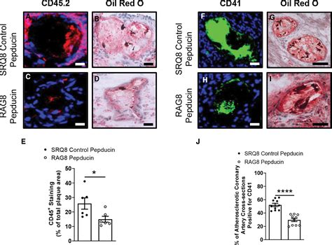 PAR4 Inhibition Reduces Coronary Artery Atherosclerosis And Myocardial