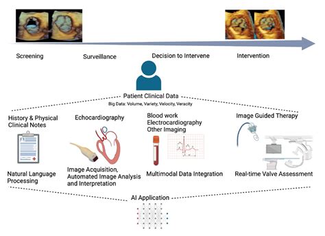 Artificial Intelligence For The Echocardiographic Assessment Of