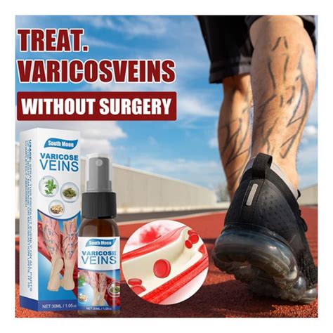 Pcs Vein Cure Tratamiento De Venas Varicosas Spray Cuotas Sin