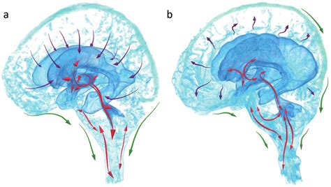 Two Types Of Normal Pressure Hydrocephalus A Secondary Normal Download Scientific Diagram