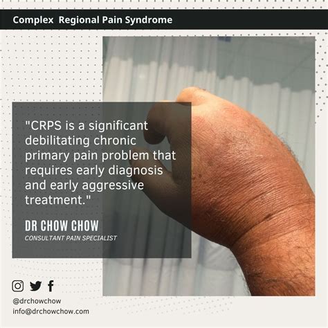 Complex Regional Pain Syndrome Crps Rsd Lawyer