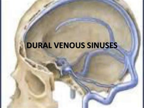 Dural venous sinuses