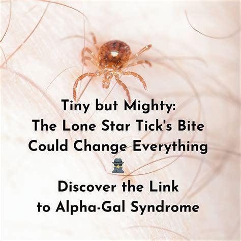 Understanding Alpha Gal Syndrome Causes Symptoms And Prevention