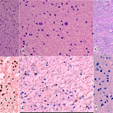 A Y B Hande C Alcian Blue D S 100 E Sinaptofisina F Ki 67 Download Scientific Diagram