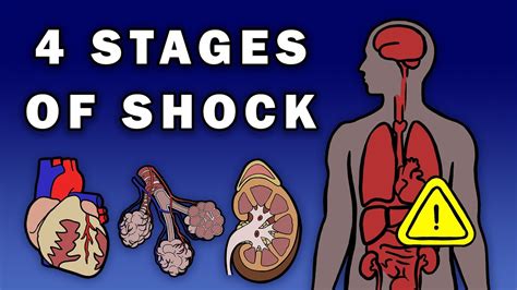 THE 4 STAGES OF SHOCK - YouTube