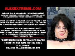 Dirtygardengirl Extreme Prolapse Pornstar Get Anal Fisting From Alexthorn Xxx Mobile Porno