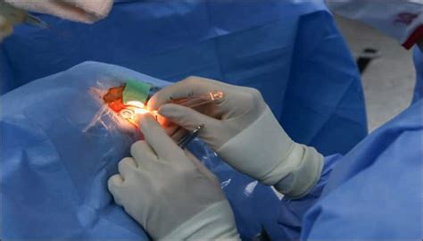 World's first robotic eye surgery performed in Britain! | Health News ...