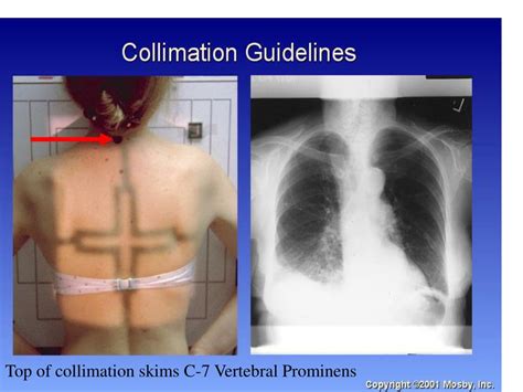 PPT Basic Radiographic Procedures CHEST LAB PowerPoint Presentation