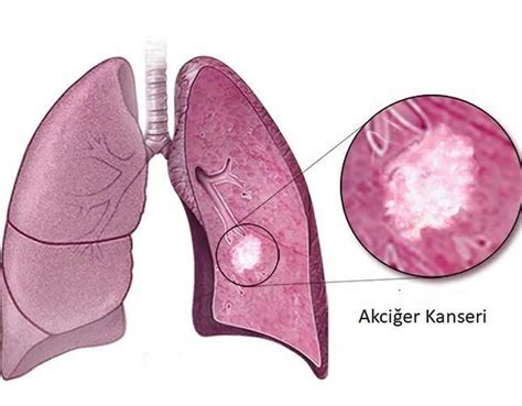 Anasayfa Prof Dr Meral Günaldı