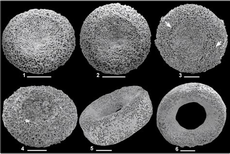 Scanning Electron Microscopy Images Of Type 4 Columnals 1 2 BMNH