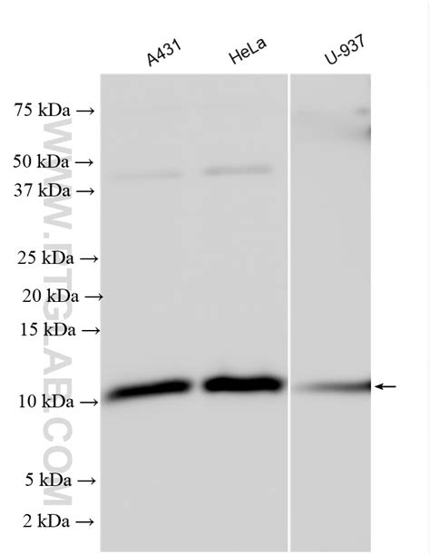 Beta 2 Microglobulin Antibody 30226 1 Ap Proteintech