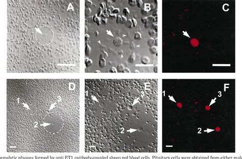 Pdf Endothelin Is An Autocrine Regulator Of Prolactin Secretion