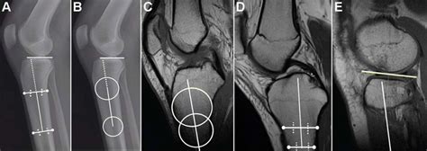 Illustrations Of The PTS Measurement Methods Considered In The Current